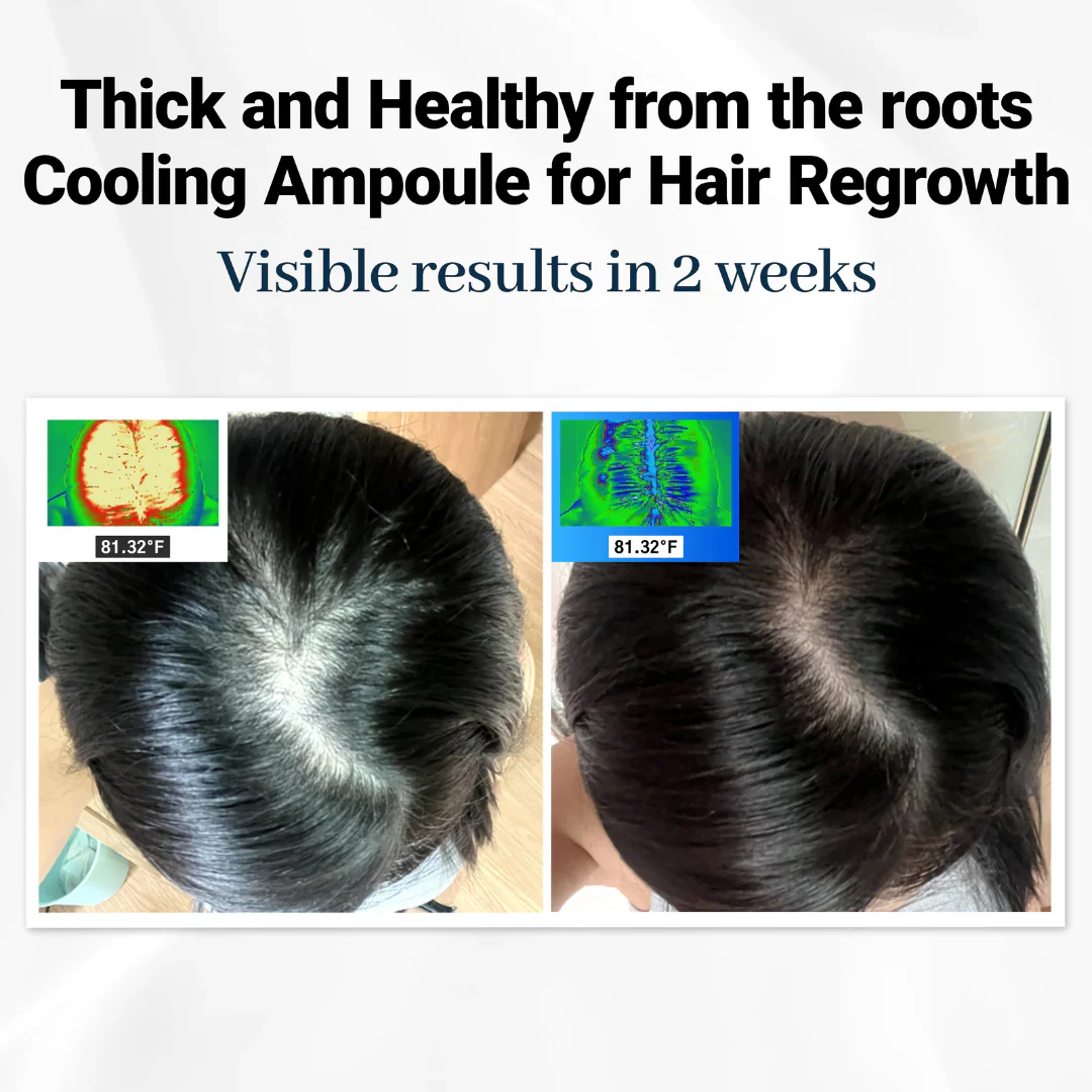 Clofina™ Cooling Hair Growth Accelerator