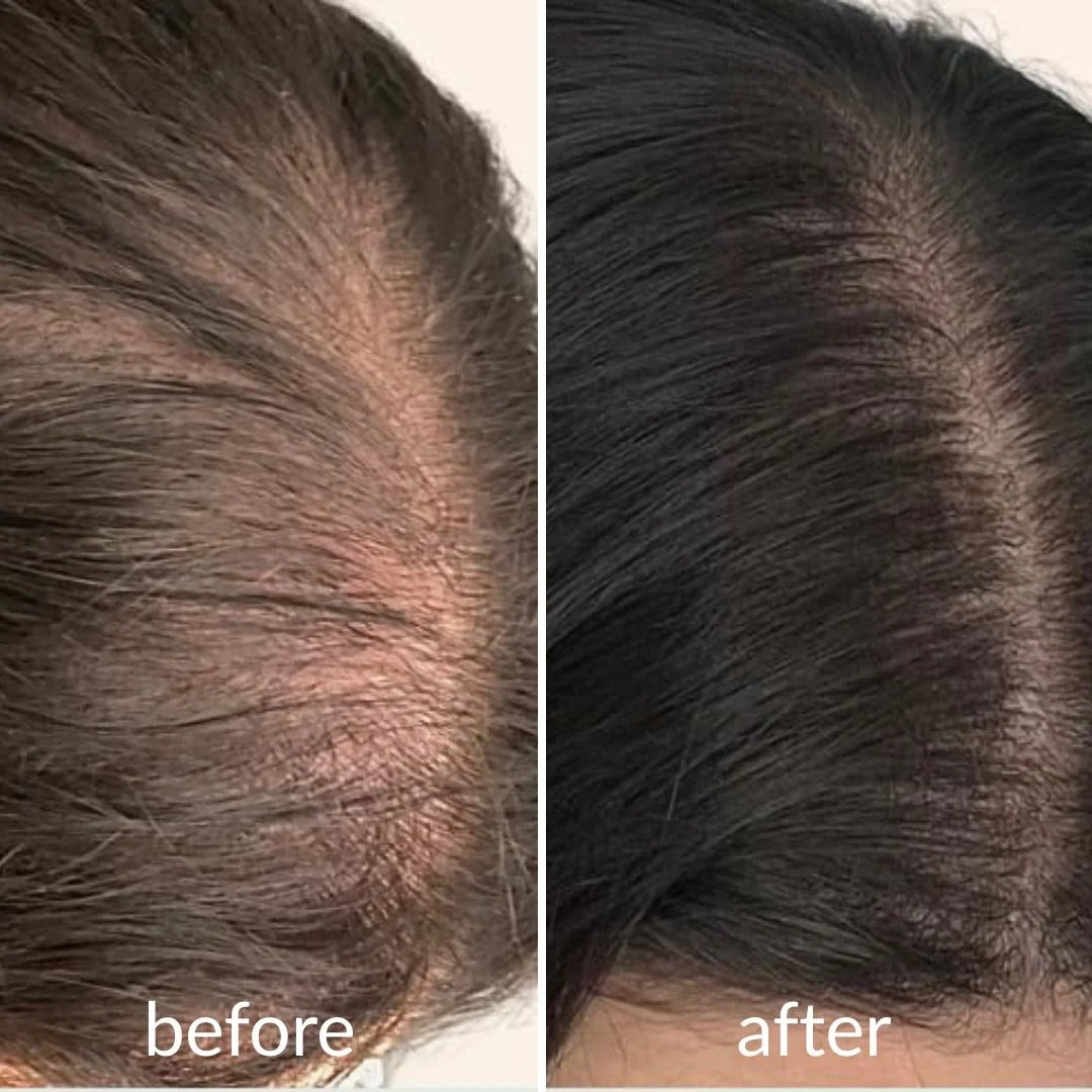 Clofina™ Cooling Hair Growth Accelerator