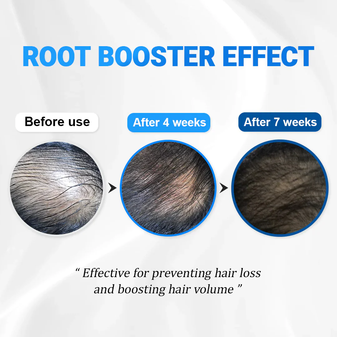 Clofina™ Cooling Hair Growth Accelerator