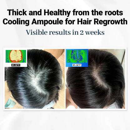 Clofina™ Cooling Hair Growth Accelerator