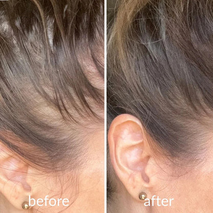 Clofina™ Cooling Hair Growth Accelerator